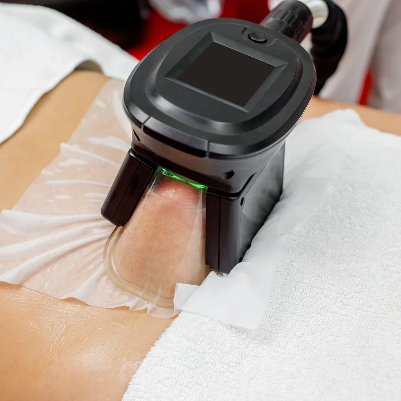 Fat Freezing treatment Southend-on-Sea